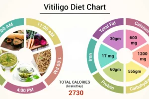 Ayurvedic cure for vitiligo