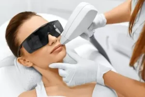 laser hair removal Dubai