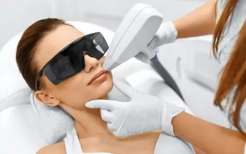 laser hair removal Dubai