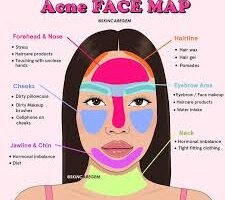 Face Acne