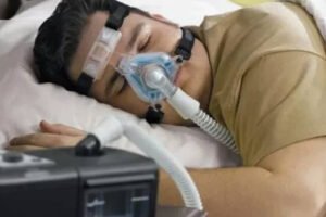 sleep apnea appliance
