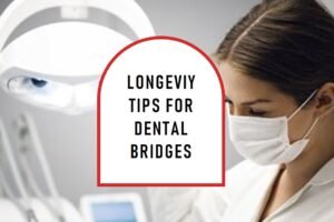 Longevity-Tips-for-Dental-Bridges.